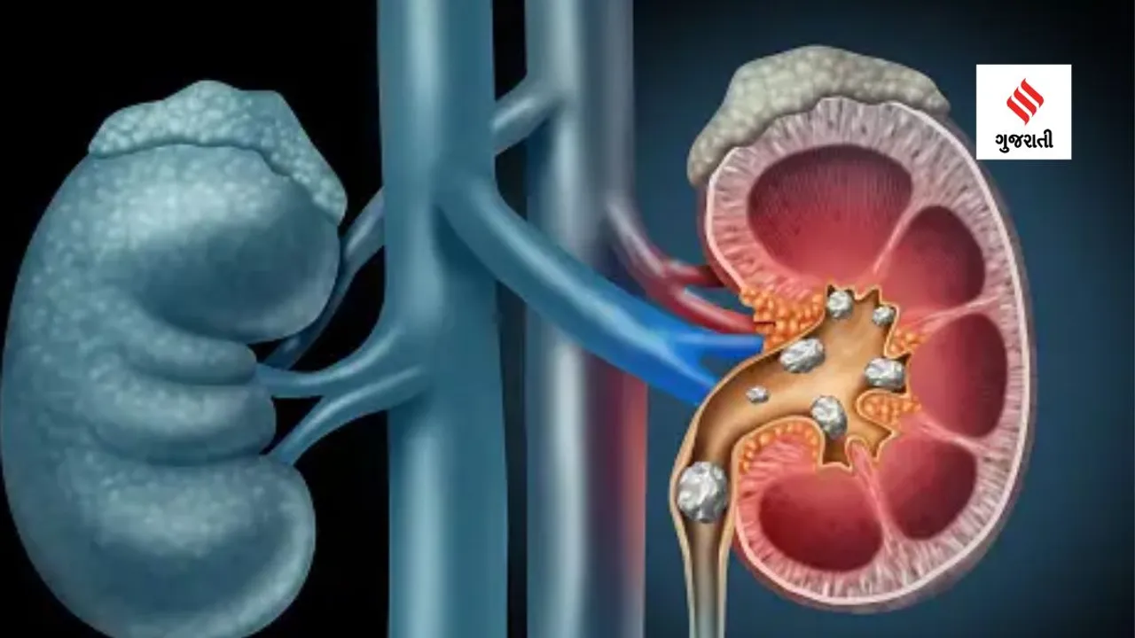 Consume these foods to keep kidneys healthy