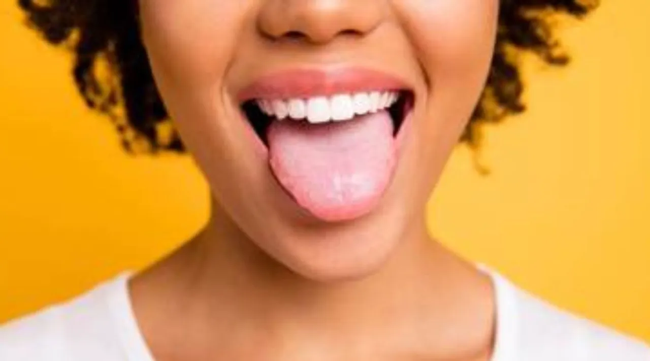 If red spots appear on the tongue, it is called geographic tongue.