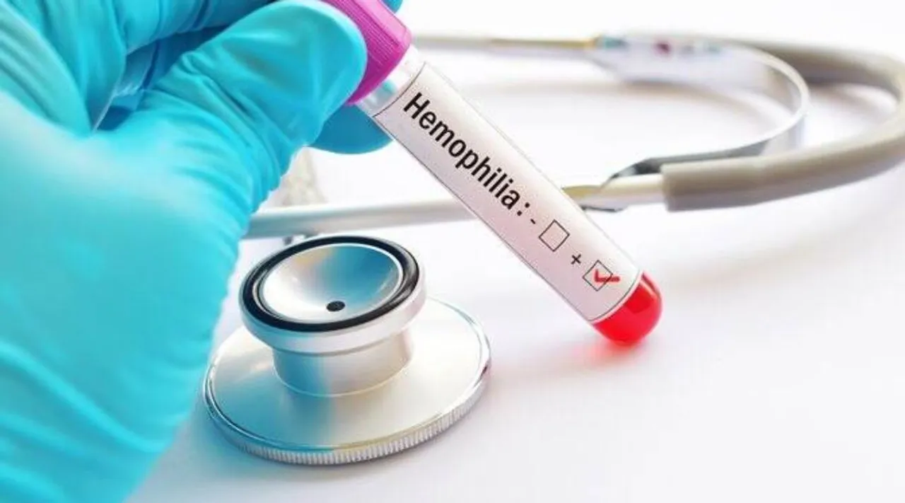 Haemophilia is caused by a defect in the X chromosome.