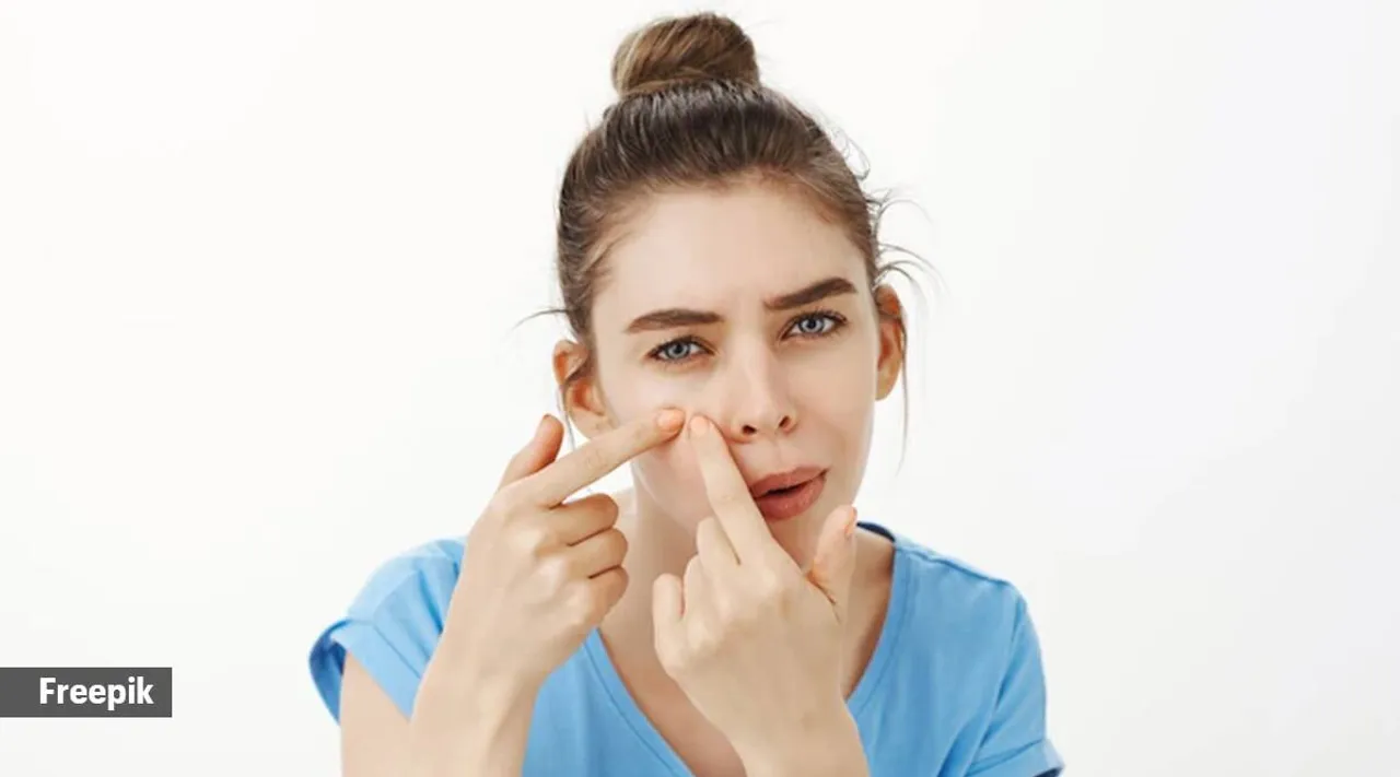 Tea tree oil contains antimicrobial properties, which reduces inflammation.