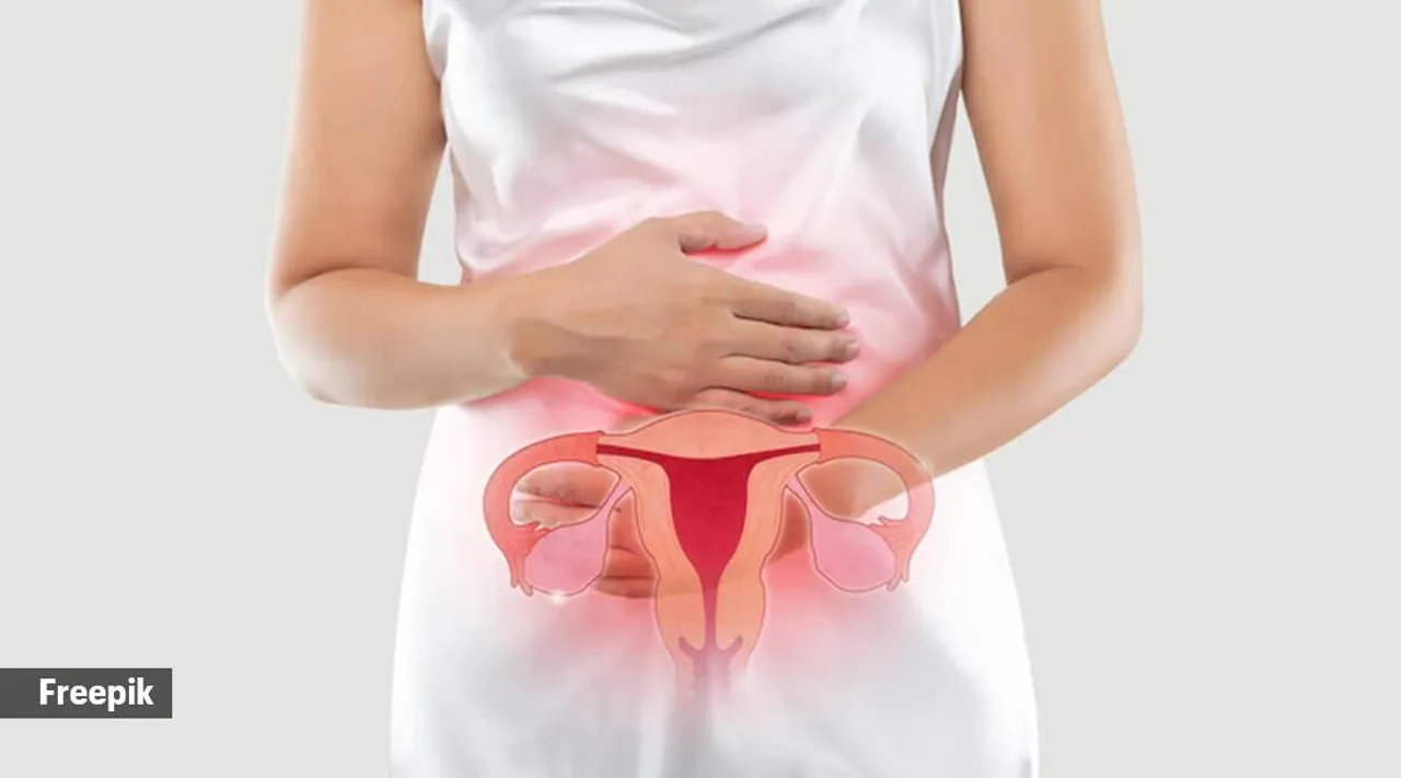 Ovarian cancer and fertility