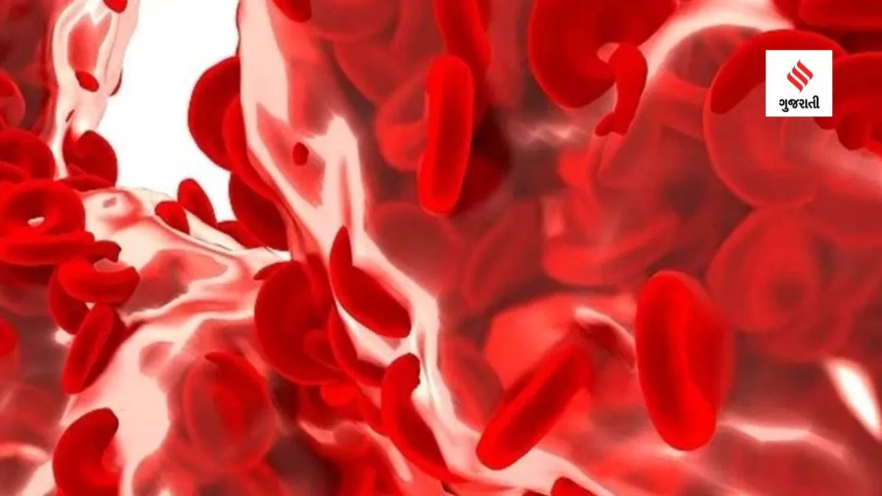 Here's what to understand about sickle cell disease and travelling