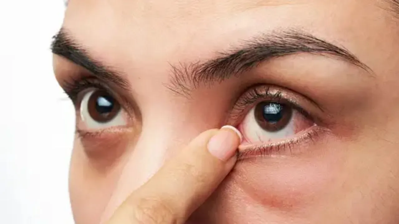 Eye diseases In Monsoon (unsplash)