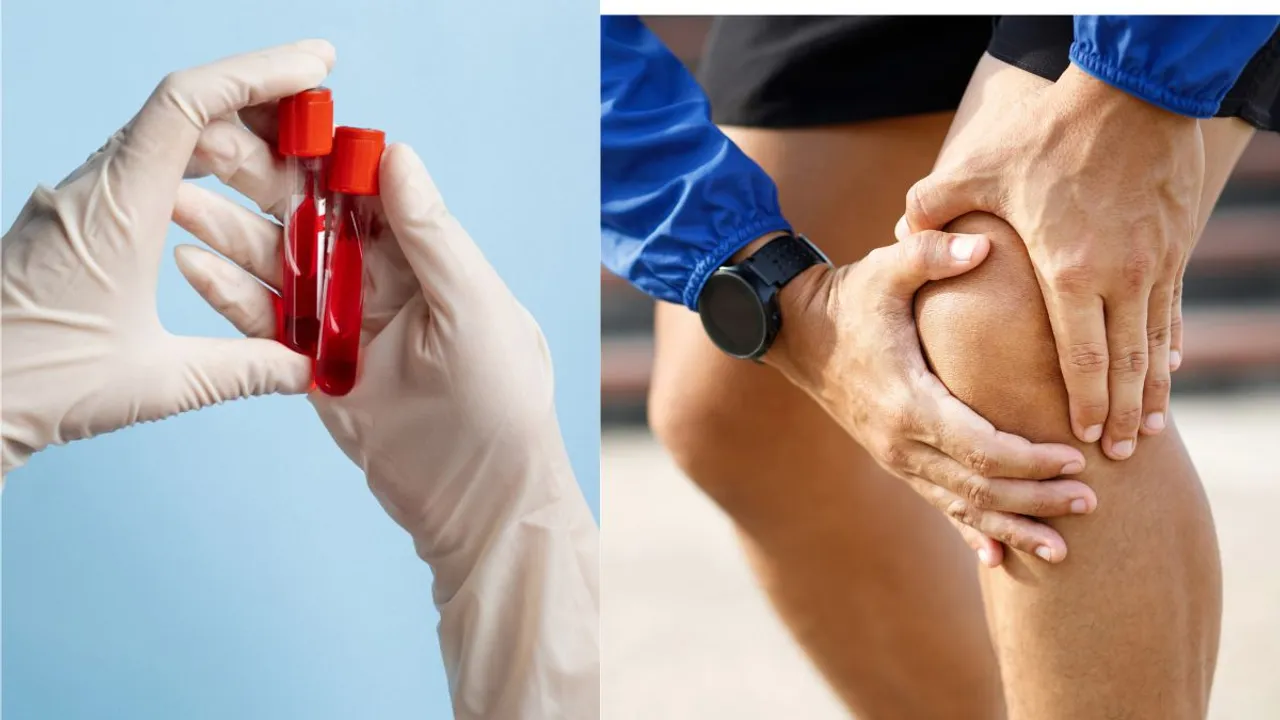 Blood Circulation | Poor Blood Circulation Symptoms | Blood Circulation remedies | Health Tips | life style