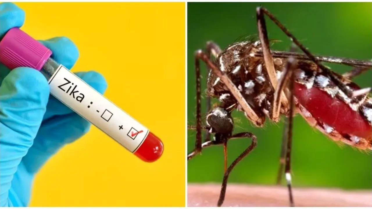 Zika Virus Symptoms | Zika Virus Prevention | Zika Virus Treatment | causes of zika virus | Health tips for zika virus | zika virus transmission