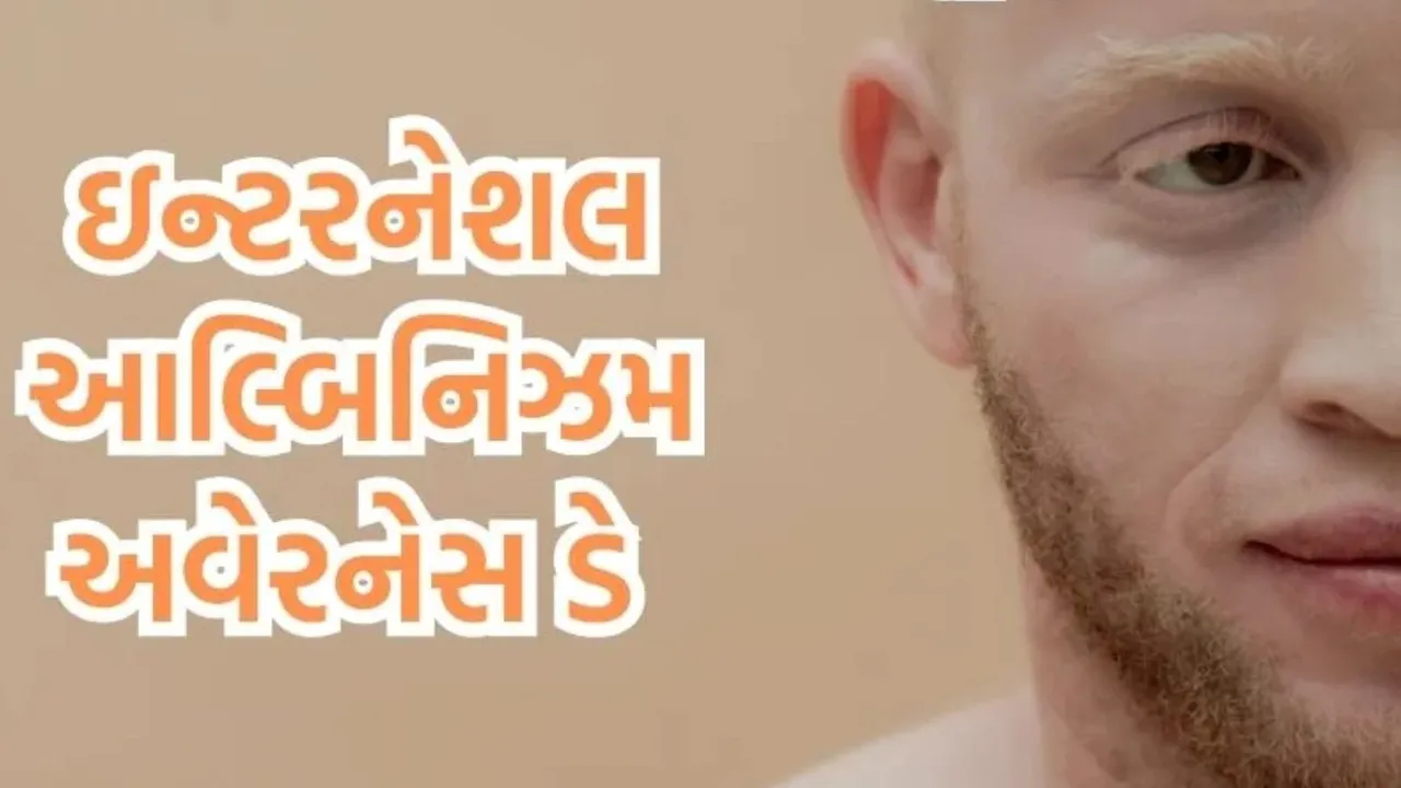 International Albinism Awareness Day, International Albinism Awareness Day 2024