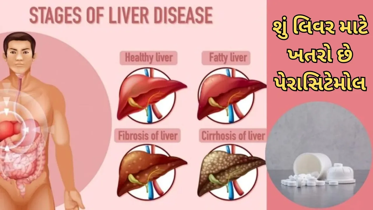Paracetamol Disadvantages