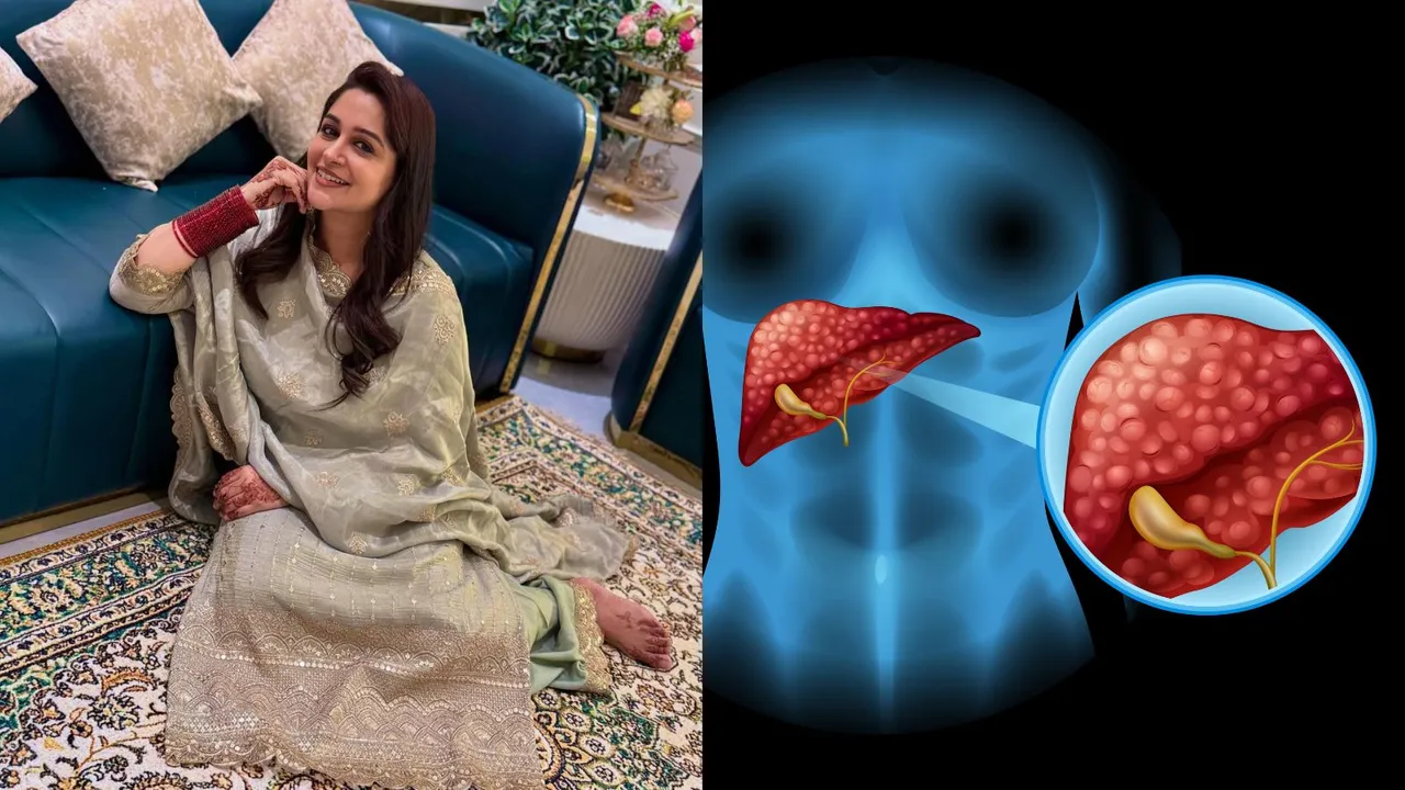 Dipika Kakar liver cancer