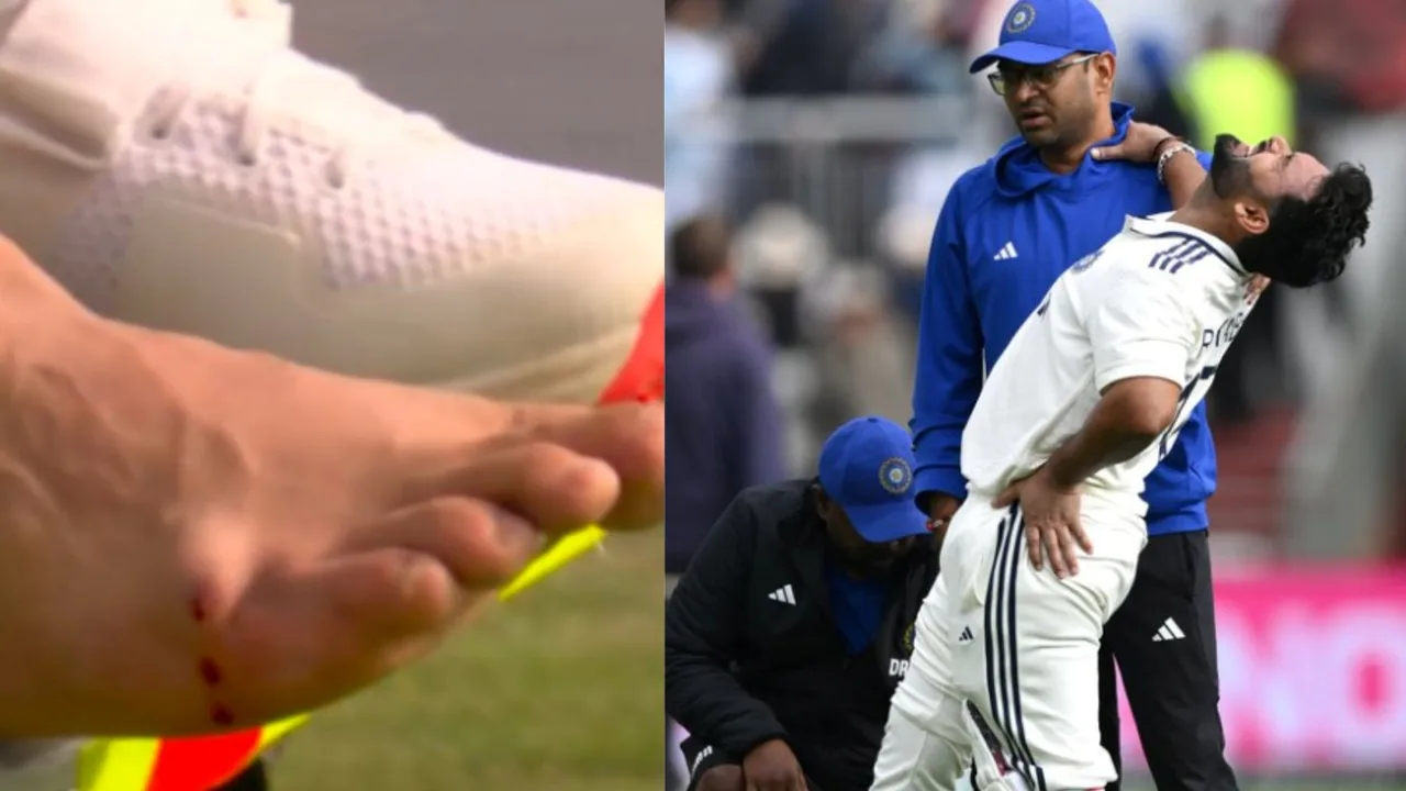 Rishabh Pant Injury, ઋષભ પંત ઇજા