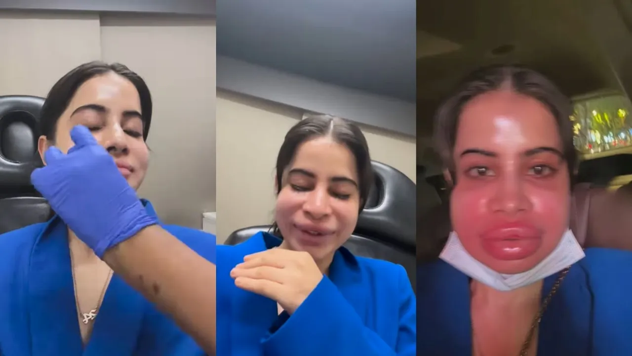 urfi javed filling lips