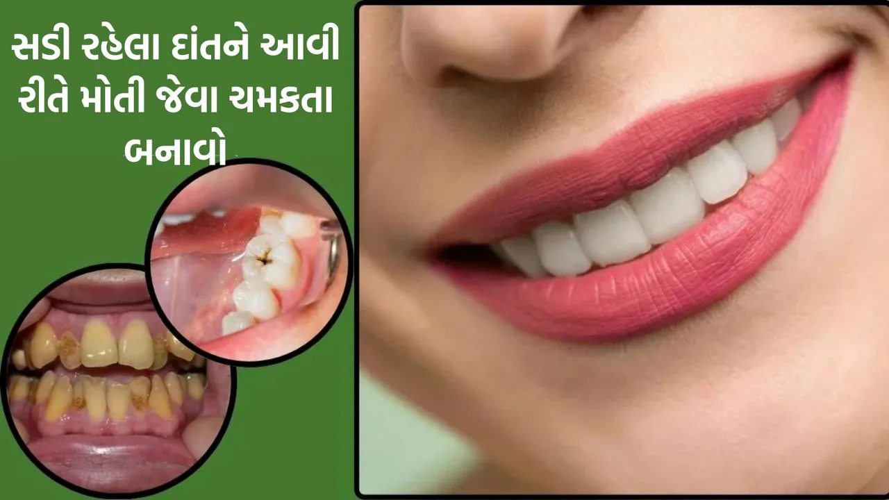 how to make white teeth, પીળા દાંતને સફેદ કેવી રીતે કરવા