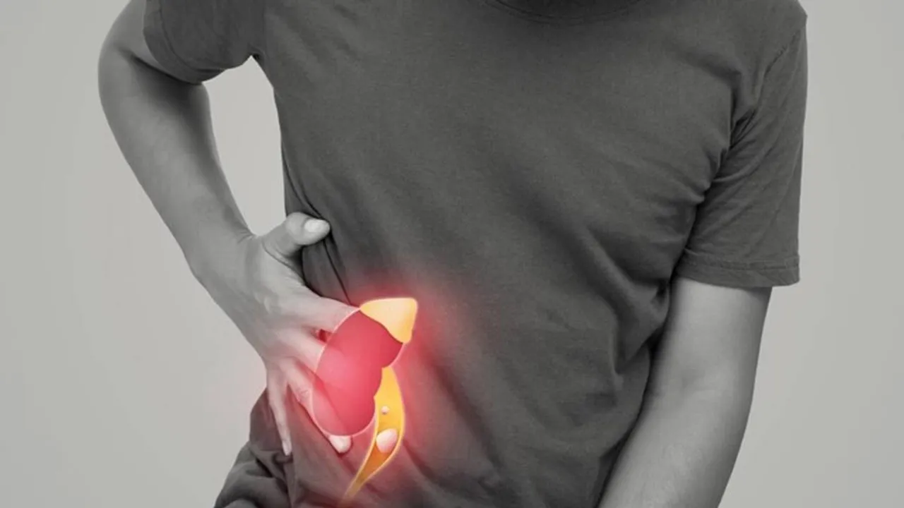 kidney stone