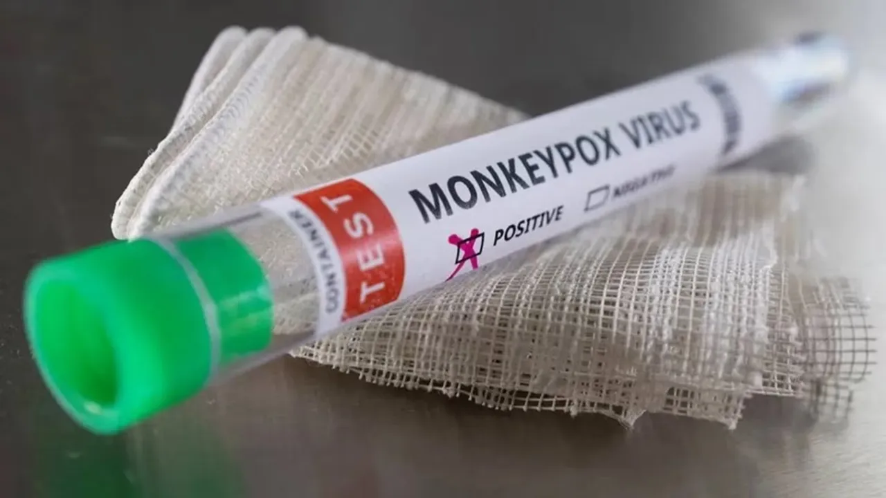 mpox