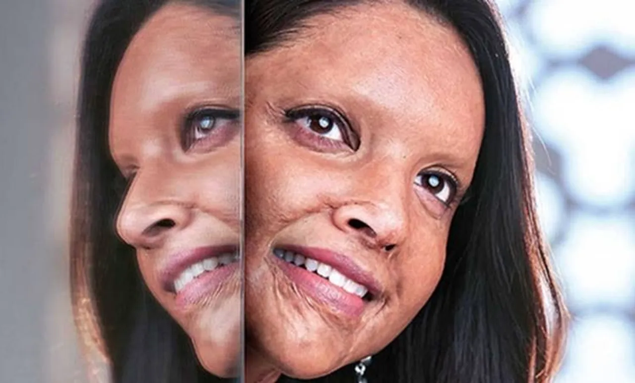Deepika Padukone, Chhapaak, Meghna Gulzar, Deepika, Malti, Laxmi Agarwal, Deepika Padukone movies, Deepika Padukone latest news, Deepika Padukone news, Deepika Padukone films, ദീപിക പദുകോൺ, ചപ്പാക്ക്, മേഘ്ന ഗുൽസാർ, ലക്ഷ്മി അഗർവാൾ, ആസിഡ് ആക്രമണം, പുതിയ ചിത്രം, സിനിമ, Entertainment, സിനിമാ വാര്‍ത്ത, ഫിലിം ന്യൂസ്, Film News, കേരള ന്യൂസ്, കേരള വാര്‍ത്ത, Kerala News, മലയാളം ന്യൂസ്, മലയാളം വാര്‍ത്ത, Malayalam News, Breaking News, പ്രധാന വാര്‍ത്തകള്‍, ഐ ഇ മലയാളം, iemalayalam, indian express malayalam, ഇന്ത്യന്‍ എക്സ്പ്രസ്സ്‌ മലയാളം