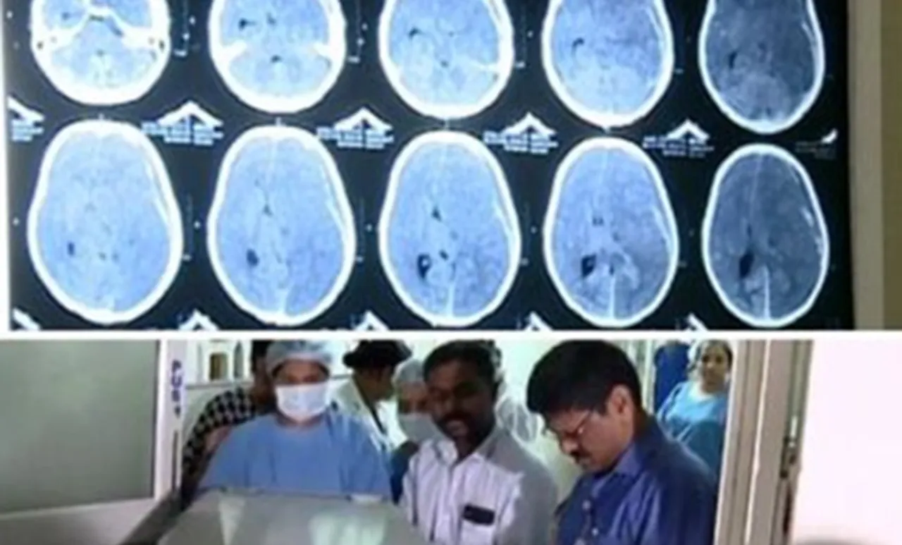 തലയോട്ടിയ്ക്കും വാരിയെല്ലിനും പൊട്ടലുകള്‍, മരണകാരണം തലയിലെ ഗുരുതര പരിക്ക്