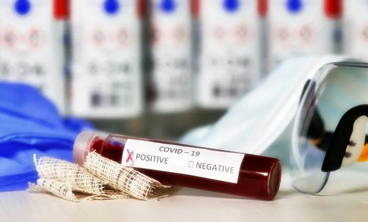 Coronavirus, കൊറോണ വൈറസ്, Covid-19, കോവിഡ്-19 coronavirus in india, കൊറോണ വൈറസ് ഇന്ത്യയിൽ, ppe, ventilator, പിപിഇ, വെന്റിലേറ്റർ, PM, Prime Minister, PM Modi, Modi, Narendra Modi, പ്രധാനമന്ത്രി, പ്രധാനമന്ത്രി മോഡി, മോഡി, നരേന്ദ്ര മോഡി. Thablighi, തബ്ലീഗ്, Jamaat, ജമാഅത്ത്, Nizamuddin,നിസാമുദ്ദീൻ, MOH, Health Ministry, ആരോഗ്യ മന്ത്രാലയം, coronavirus in kerala, coronavirus kerala, കൊറോണ വൈറസ് കേരളത്തിൽ, coronavirus news, കൊറോണ വൈറസ് വാർത്തകൾ, corona kerala live updates, covid 19 live updates, corona kerala live, coronavirus test, corona test, കൊറോണ വൈറസ് പരിശോധന, coronavirus symptoms, symptoms of corona,കൊറോണ വൈറസ് ലക്ഷണങ്ങള്‍,Covid Kasrgod, കാസർകോഡ് കോവിഡ്,coronavirus update,coronavirus latest, coronavirus latest news,കൊറോണ വൈറസ് ലേറ്റസ്റ്റ്, coronavirus malayalam, corona treatment,coronavirus treatment,കൊറോണ ചികിത്സ, coronavirus medicine, corona medicine, കൊറോണ വൈറസ് മരുന്ന്, iemalayalam, ഐഇ മലയാളം