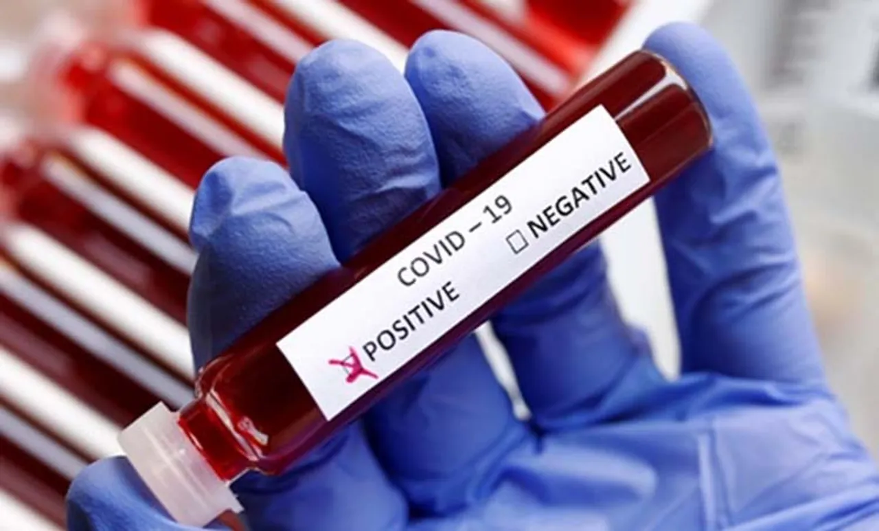 coronavirus, ICMR scientist tests positive, coronavirus tests in india, coronavirus pandemic, coronavirus testing centres, icmr, icmr on coronavirus testing, cornavirus test kits, coronavirus india cases