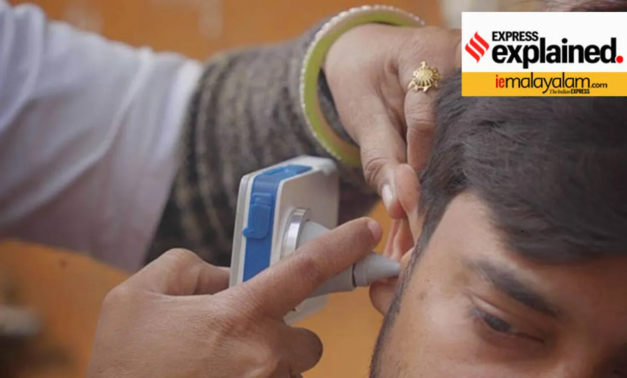 covid-19, കോവിഡ്-19, coronavirus, കൊറോണ വൈറസ്, hearing loss, കേൾവിശക്തി കുറയൽ, covid hearing loss, hearing loss after covid, കോവിഡാനന്തര കേൾവിശക്തി കുറയൽ, covid 19 impact, കോവിഡ്-19 പ്രത്യാഘാതം, coronavirus impact, കൊറോണ വൈറസ് പ്രത്യാഘാതം, post covid complications, കോവിഡാനന്തര പ്രശ്നങ്ങൾ, covid hearing loss treatment, കോവിഡാനന്തര കേൾവിശക്തി കുറയലിനു ചികിത്സ, post covid treatment, കോവിഡാനന്തര ചികിത്സ, indian express malayalam, ഇന്ത്യൻ എക്‌സ്‌പ്രസ് മലയാളം, ie malayalam, ഐഇ മലയാളം
