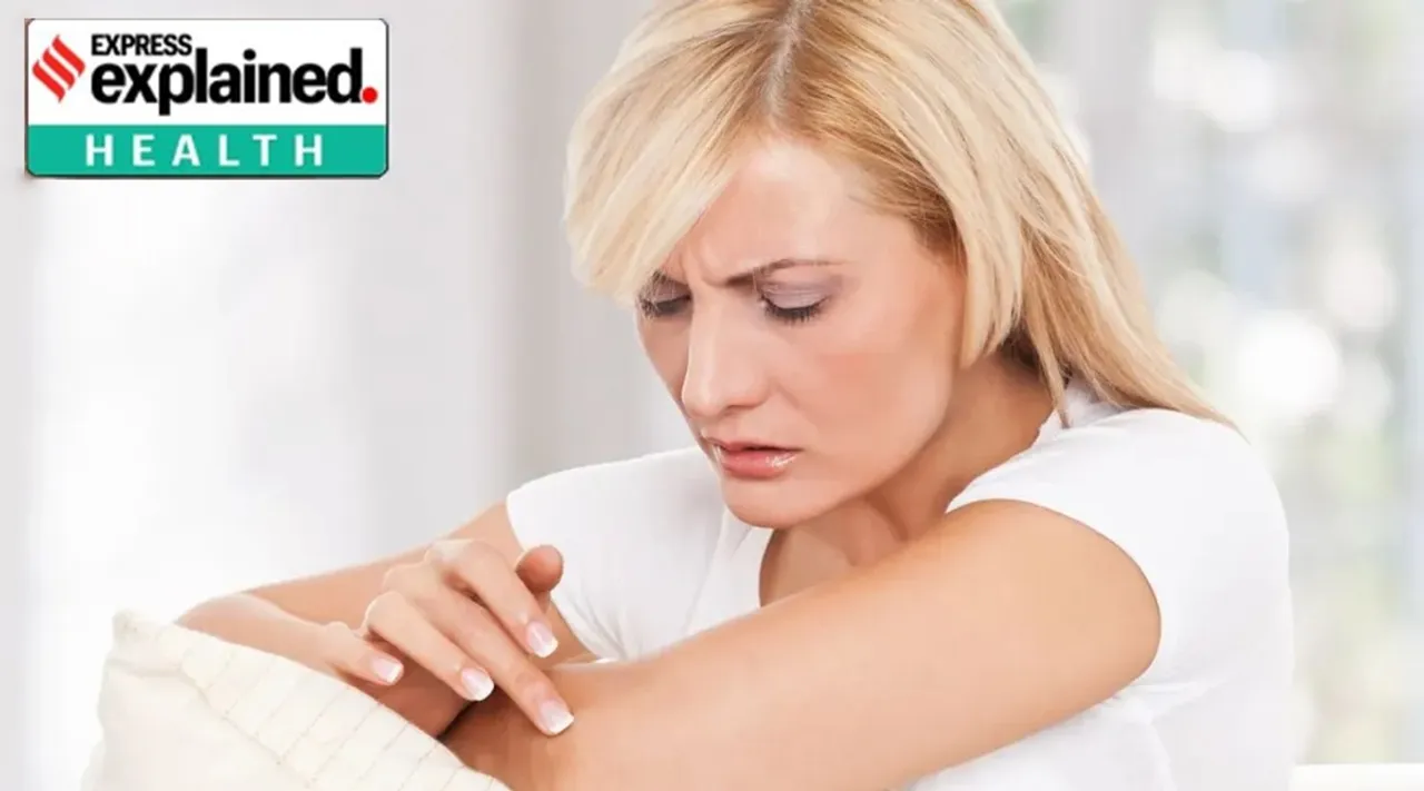 psoriasis, rashes, itchiness