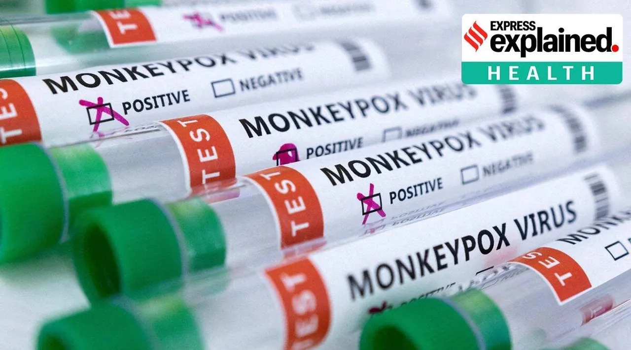 monkeypox, monkeypox symptoms, monkeypox treatment
