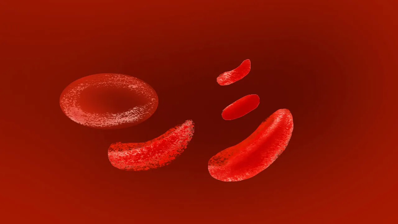 Sickle cell, Health, Union Budget