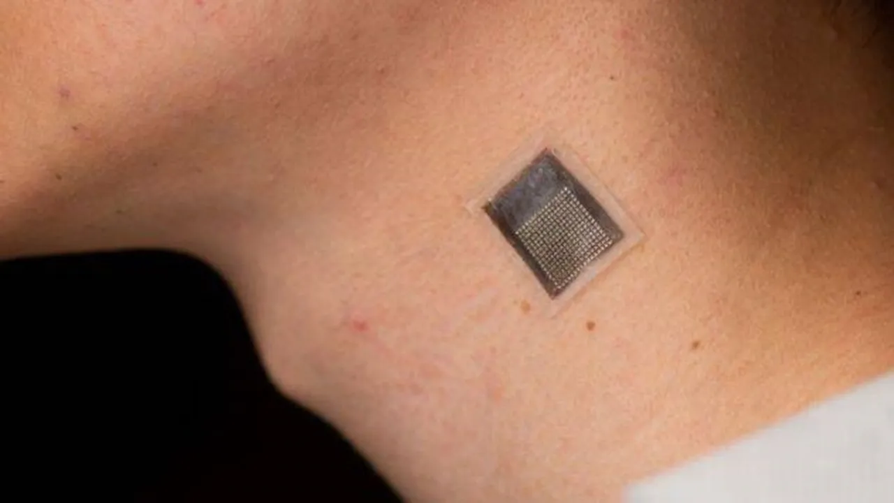 Ultrasound-sensor