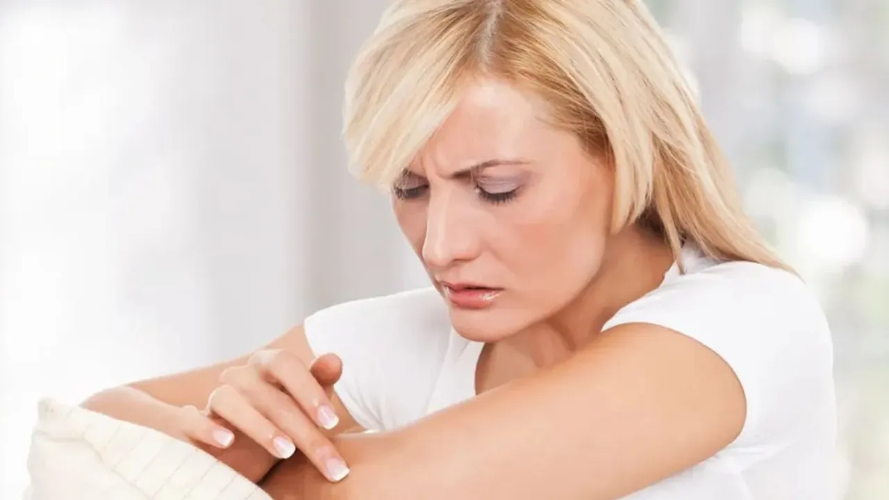 allergies, skin rash, Ayurveda, health, lifestyle, experts, doctor, skincare