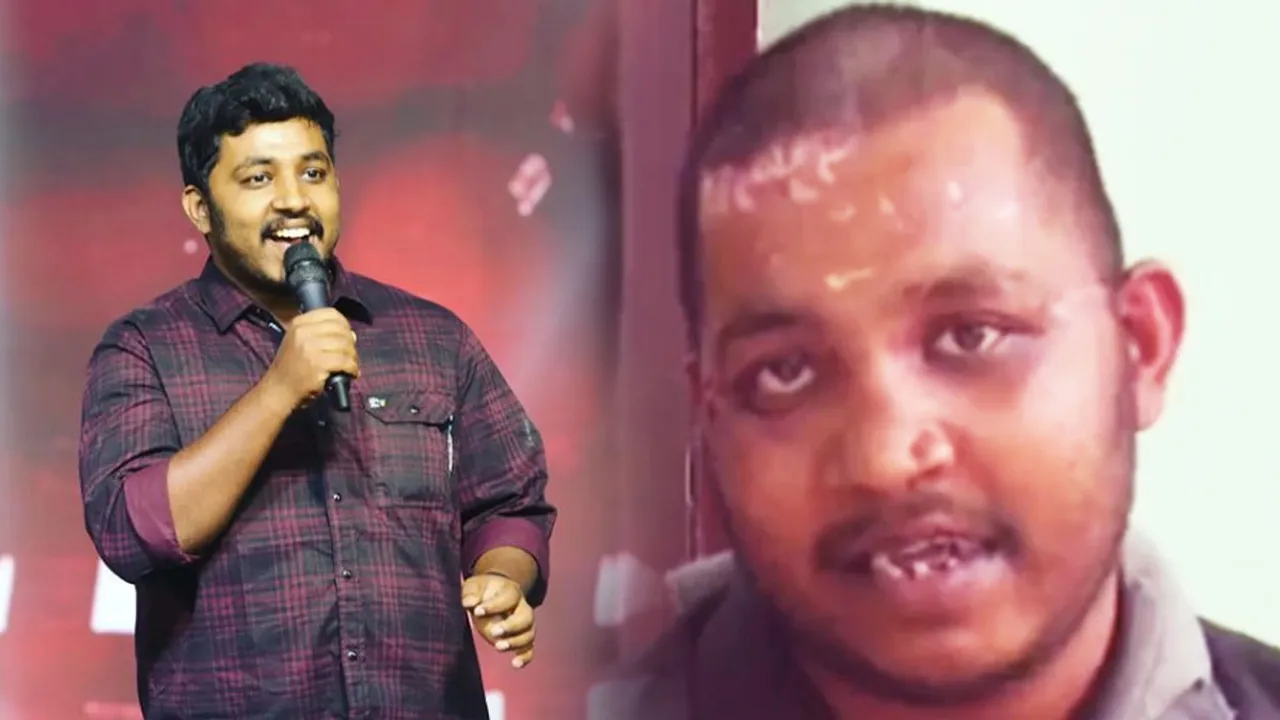 Mahesh Kunjumon| Mimicry Artist| Road Accident