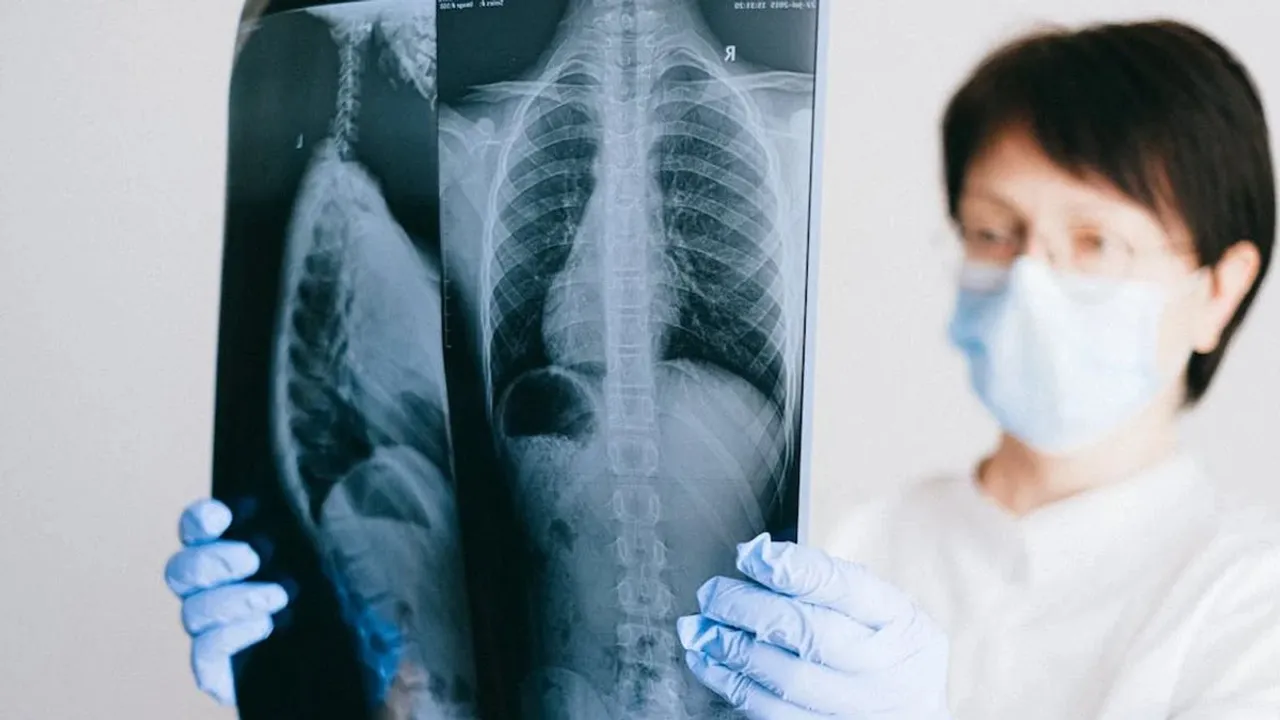 x ray|health|diabetes