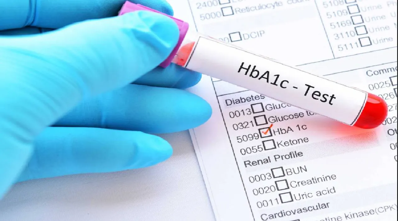 HBA1C test