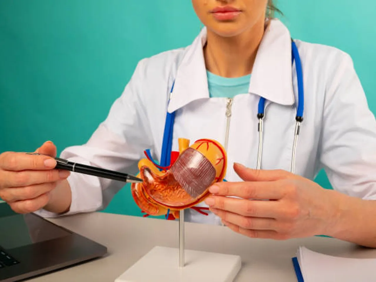 stomach cancer