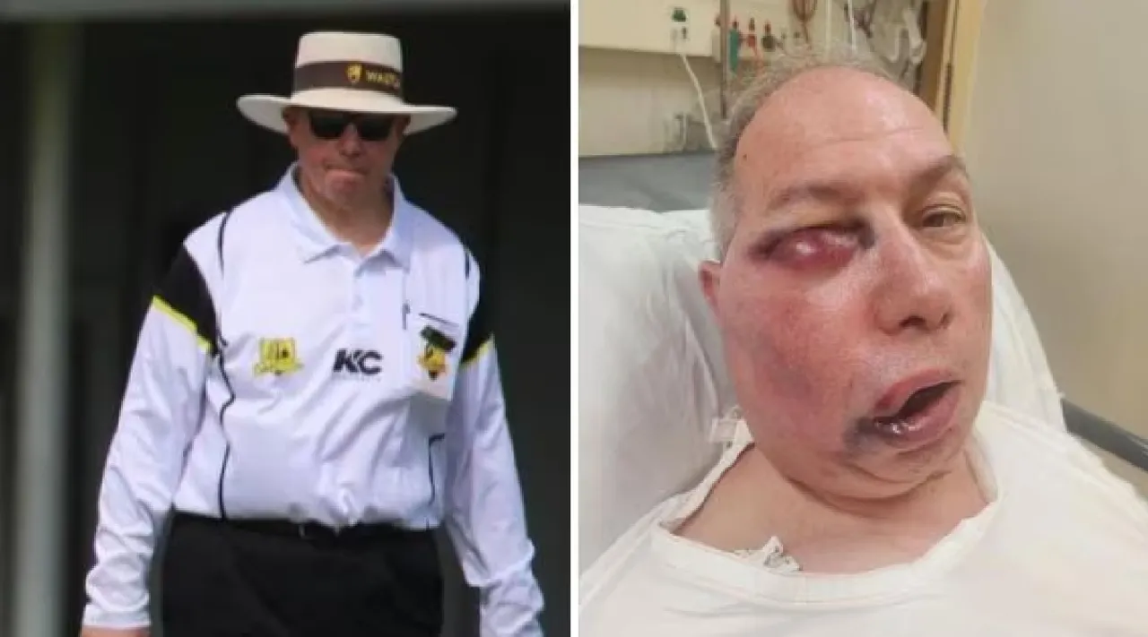 Australian cricket umpire suffers a brutal blow while officiating Tamil News