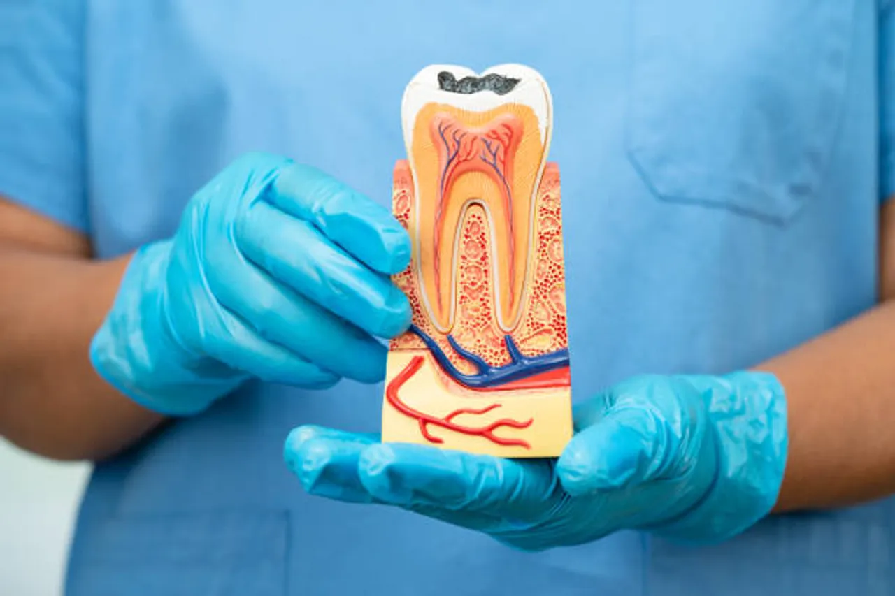 tooth implant