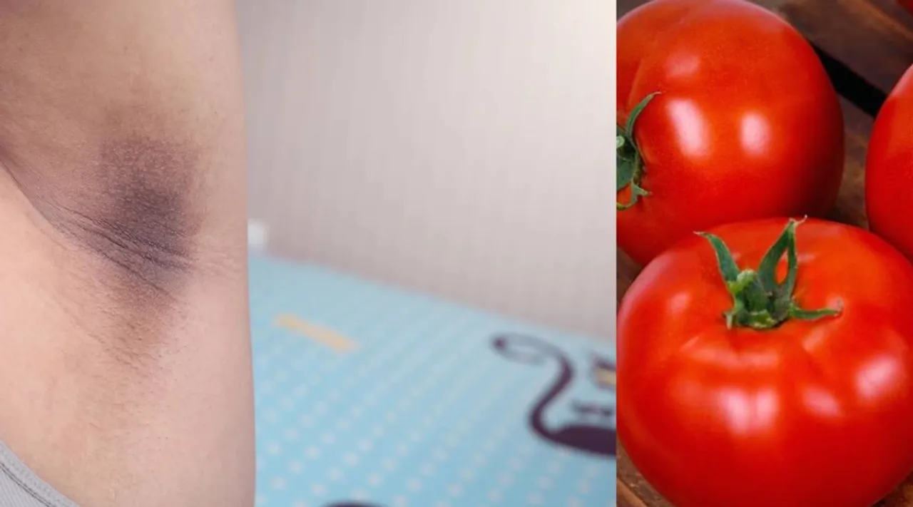 Underarm darkness removal