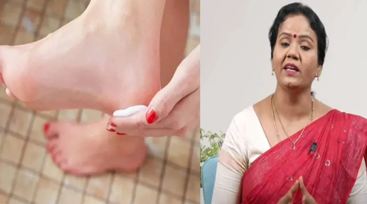  பாத வெடிப்பு