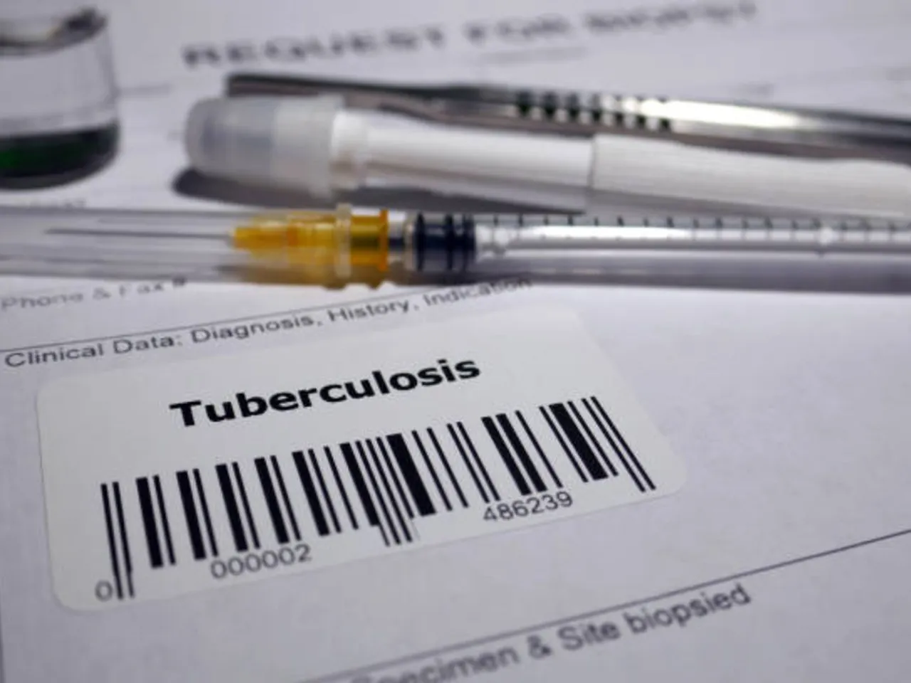 tuberculosis