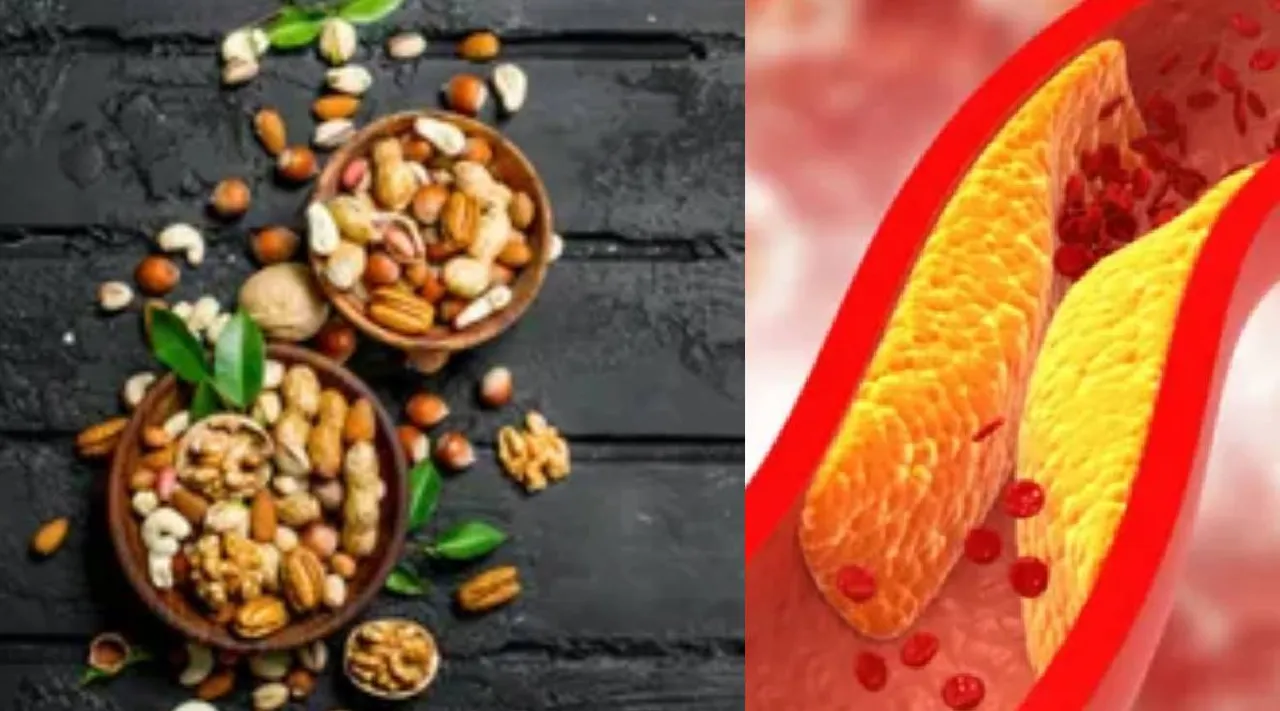 Nuts 2