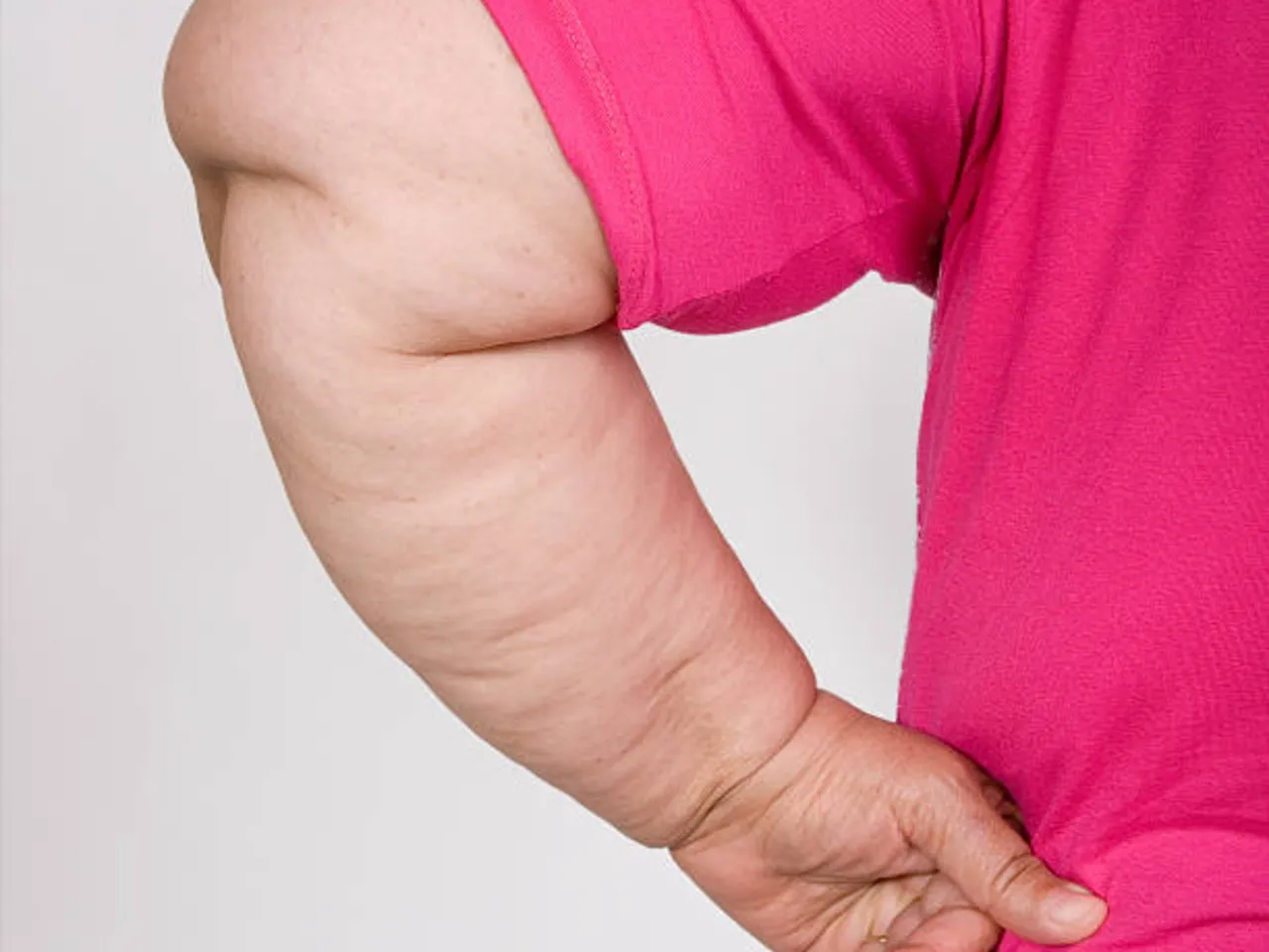 arm fat