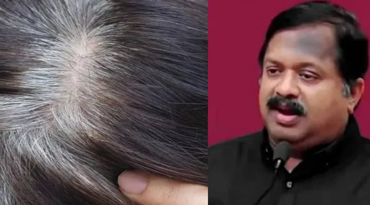 grey hairs