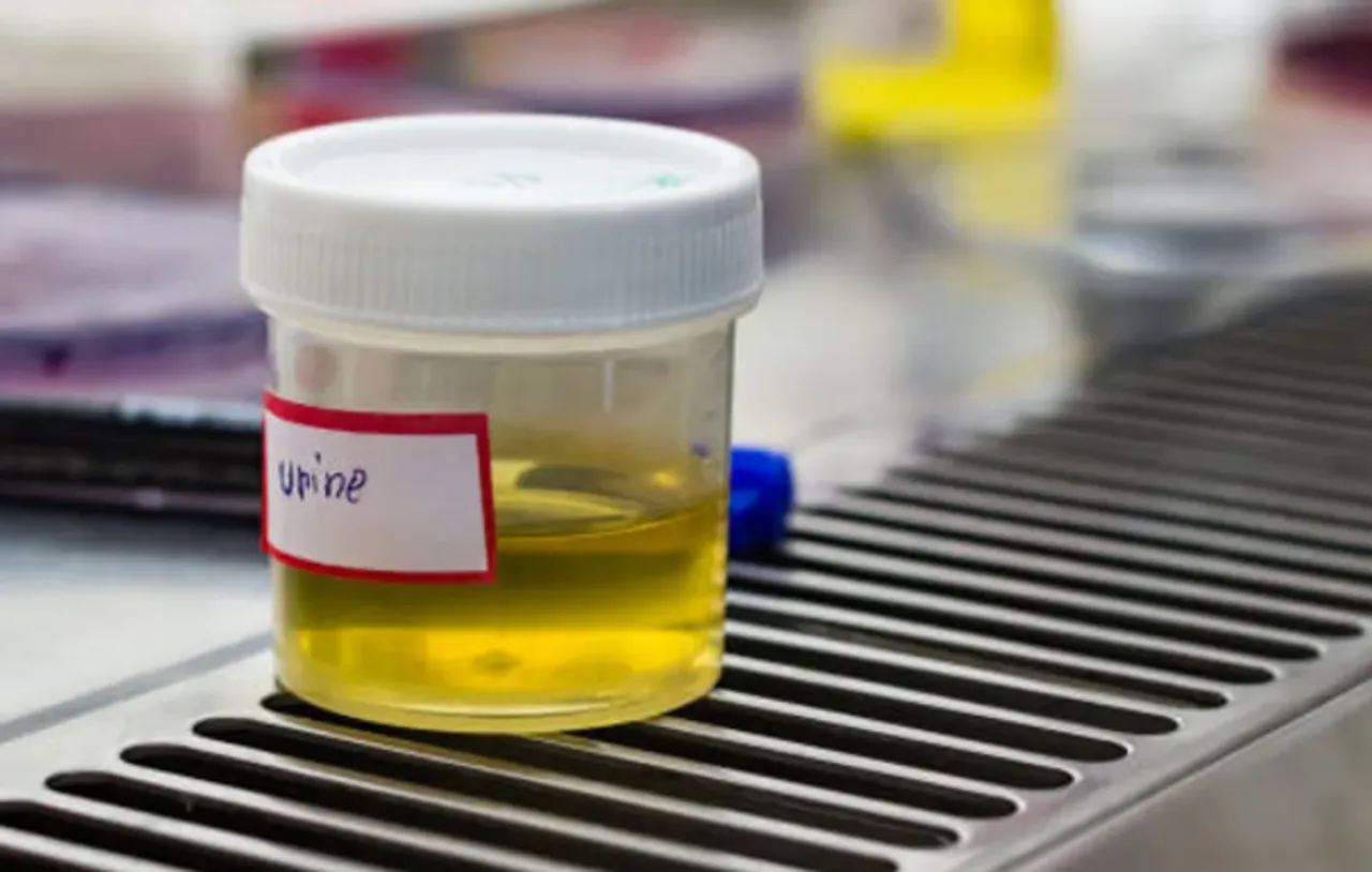 urine