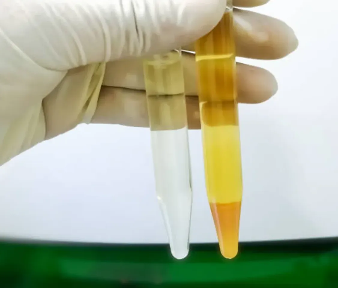 urine