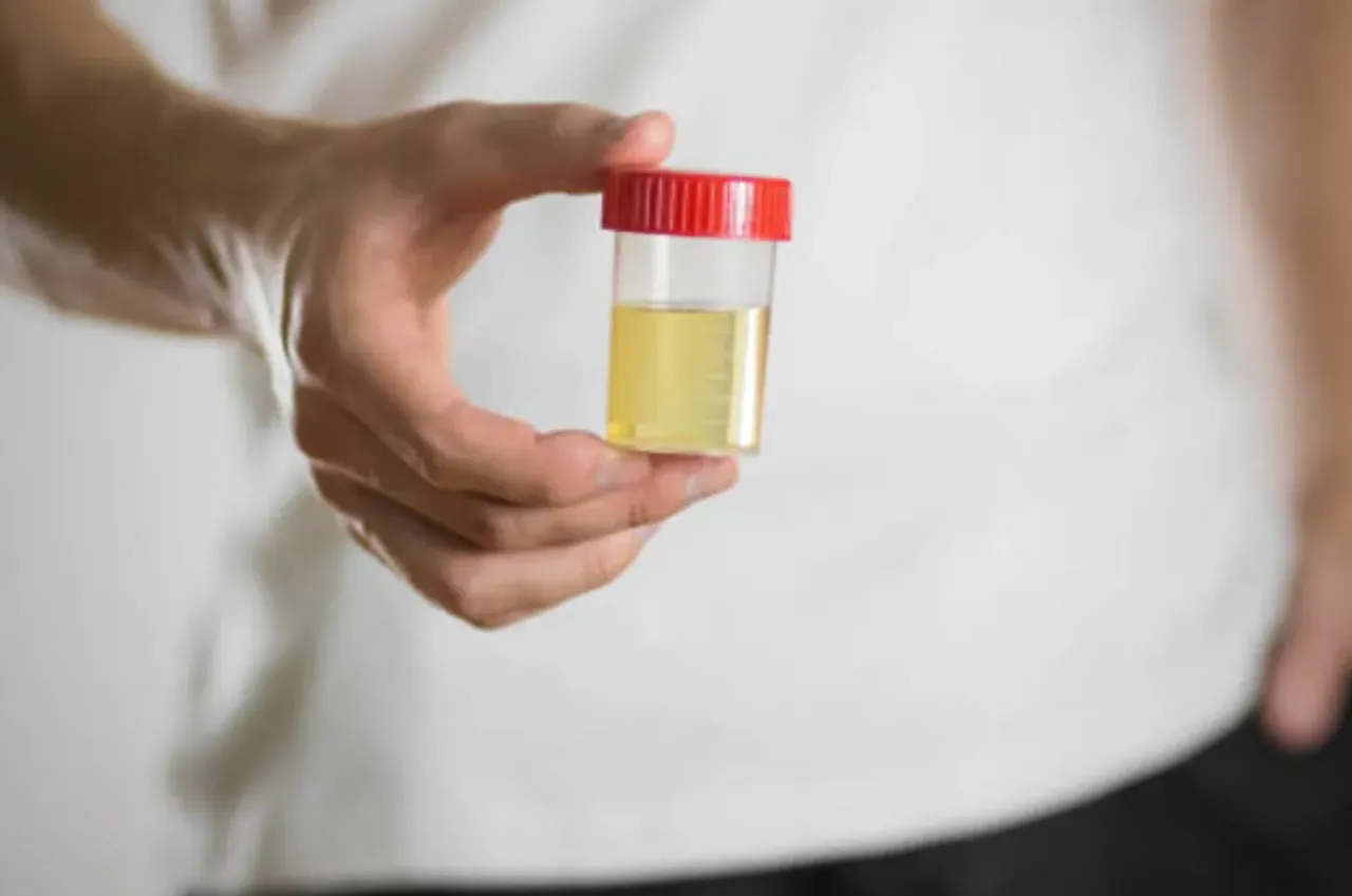 urine