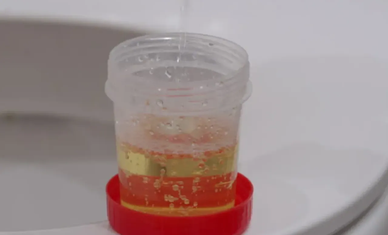 urine