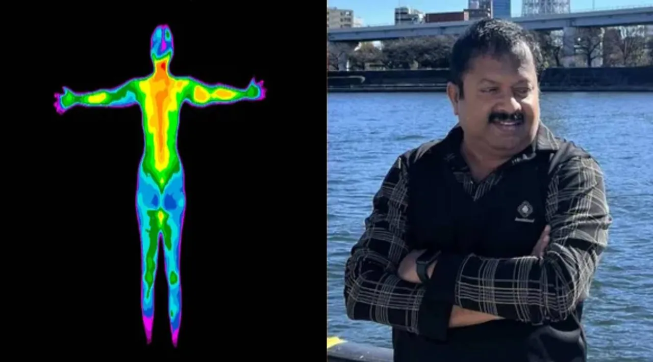 சூட்டு உடம்பு 
