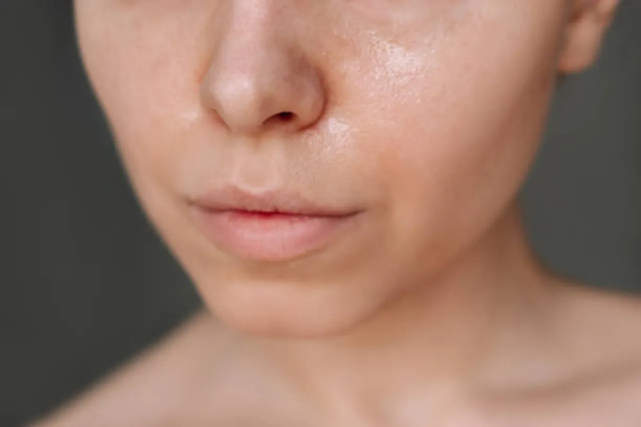 oily skin