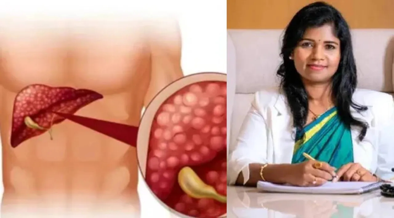 Fatty liver issue