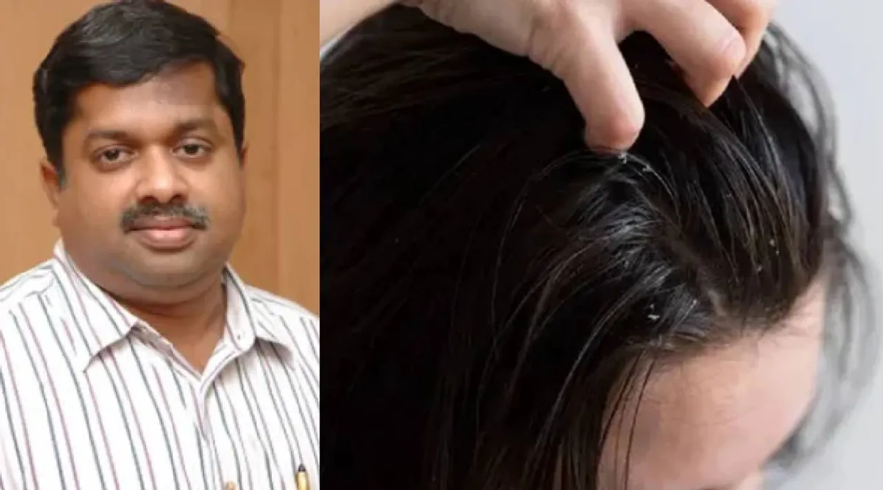 Dandruff remedy