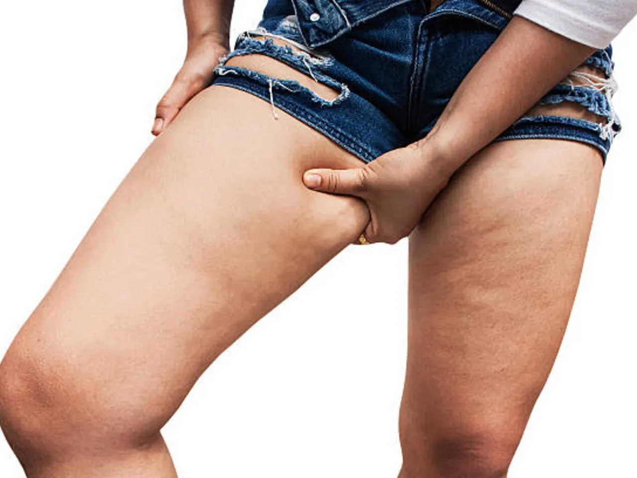 thigh fat