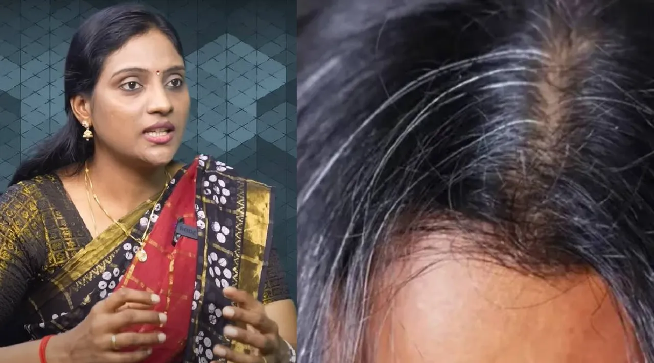 home remedy for grey hair
