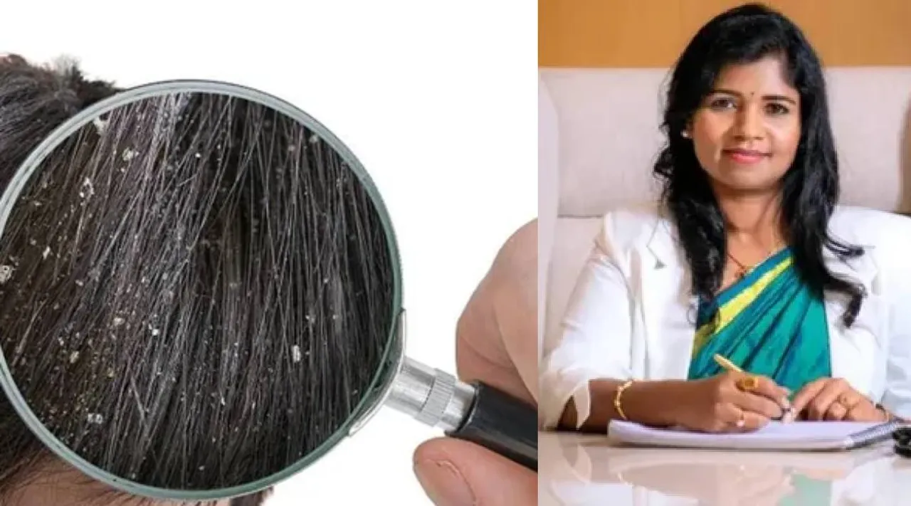 Dandruff tips
